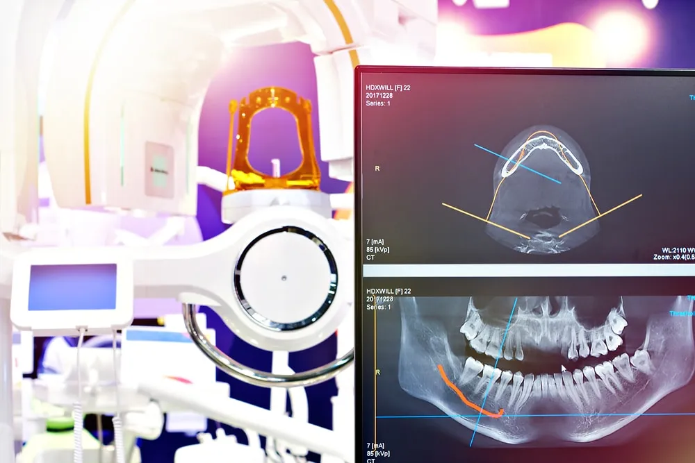 3D cone beam CT dental imaging shown on screen