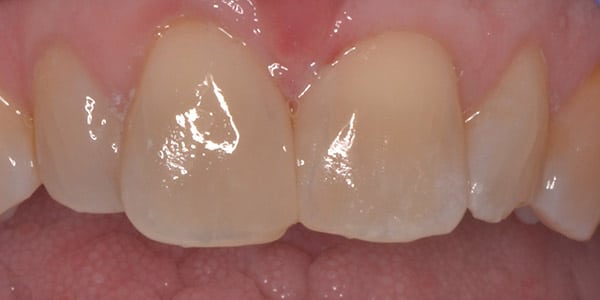 patient-9-after