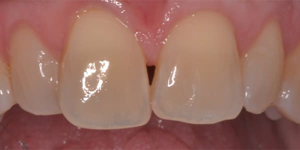 patient-9-before
