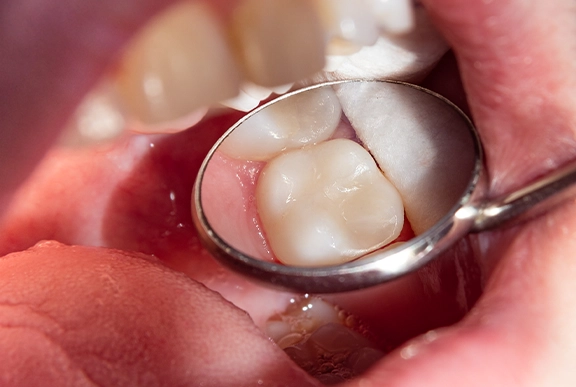 biological and non toxic dental care